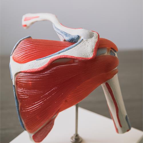 lesioni nervose della spalla: il nervo soprascapolare