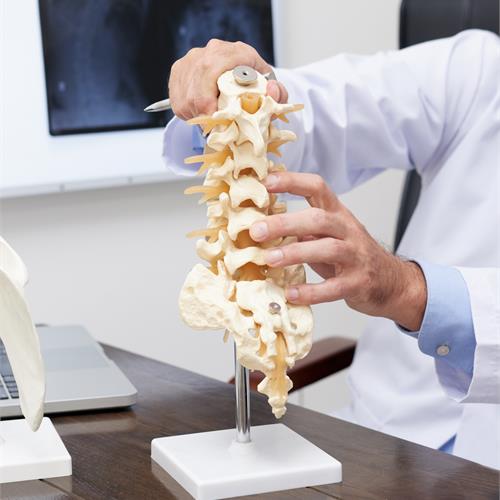 l’osteoporosi, il nemico silenzioso delle donne