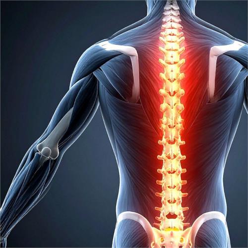 stenosi vertebrale: cos’è, sintomi, cause e trattamenti